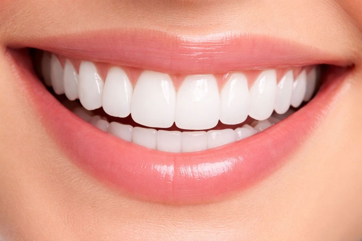 full mouth image